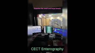 CT Scan Enterography [upl. by Vittorio589]