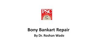 Bony Bankart Repair By Dr Roshan Wade [upl. by Rennoc]