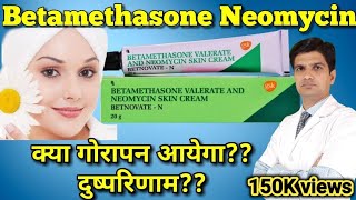 Betnovate N cream  Betamethasone Neomycin cream  betnovate n skin cream [upl. by Daggna]