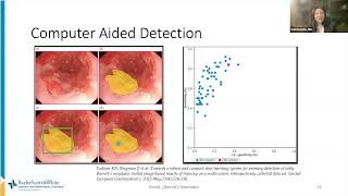 novel innovation in screening surveillance and treatment of barretts esophagus and early EAC [upl. by Wilie]