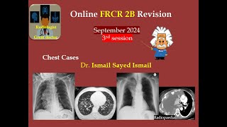 FRCR 2b Session 3 September 2024 Chest [upl. by Zealand]