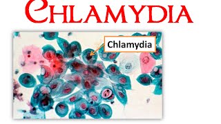 Chlamydia [upl. by Soracco]