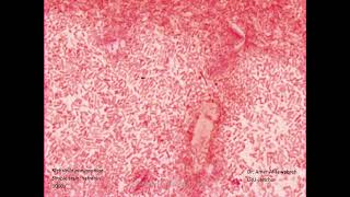 Klebsiella pneumoniae Safranin stain Simple stain [upl. by Lipcombe764]