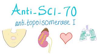 AntiScl70 Antitopoisomerase I Antibodies [upl. by Wertheimer587]