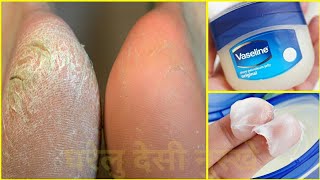 Vaseline सिर्फ 2 बार में फटी एड़ियों को कोमल बना देगा ये नुस्खा  Cracked Heels Treatment [upl. by Eibor]