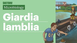 Giardia lamblia Lesson Transmission amp Treatment Full Lesson  Sketchy Medical  USMLE Step 1 [upl. by Holladay]