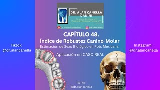 CAPÍTULO 48 Índice de Robustez CaninoMolar Est de Sexo Biológico en Pob Mexicana CASO REAL [upl. by Neltiac]