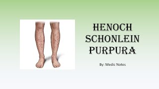 HenochSchonlein purpura  clinical features investigation treatment complication prognosis [upl. by Soren270]