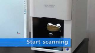 Intelligent Dental Scanner RexcanDS2 SOLUTIONIX [upl. by Anelrac348]