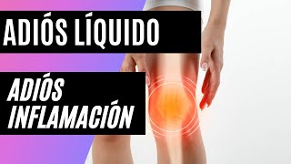 LÍQUIDO EN LA RODILLA 🔷 COMO CURAR CON EJERCICIOS EN CASA 🤔 [upl. by Cofsky]