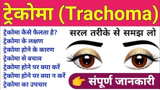 TRACHOMA BY DRPAWAN GUPTA [upl. by Onirotciv]