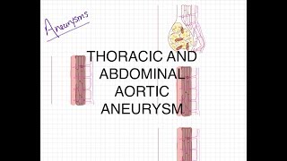 Pathophysiology of Aortic Aneurysms [upl. by Anitnatsnok]