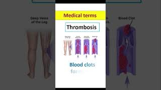 Common medical terms  Medical terminology medicine pharmacy medicalabbreviations pharmacology [upl. by Derayne560]