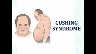 Cushing syndrome mrcpch Video station [upl. by Veljkov]