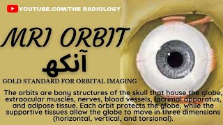 How to Have MRI Orbit Eye [upl. by Maurice246]