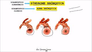 2 Síndromes Pleuropulmonares II [upl. by Analla383]