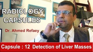 Capsule 12  Detection of Liver Masses [upl. by Immij684]