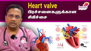 Treatment for heart valve problems  இதய வால்வு பிரச்சனைகளுக்கான சிகிச்சை [upl. by Candi]