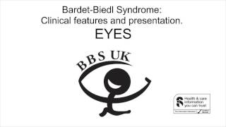 BardetBiedl Syndrome Eyes [upl. by Kimberley]