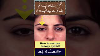 How to fix droopy eyelids without surgery  Jhuki Ankh ka ilaj [upl. by Nauqes]