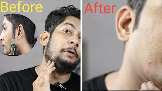 Best Trimmer For Clean Shave Like Razor [upl. by Ahsasal]