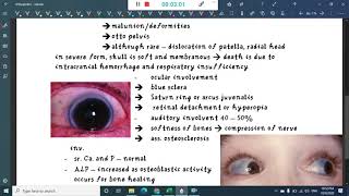 osteogenesis imperfecta  Orthopedics [upl. by Moberg]