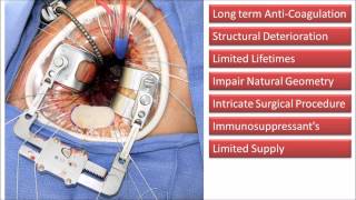 Development of a Bioengineered Decellularised Xenograft for Mitral Valve Replacement [upl. by Haydon]