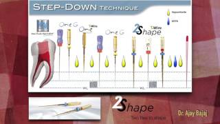 ROOT CANAL TREATMENT OF CURVED CANAL WITH 2SHAPE [upl. by Sergent]