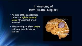 Neurophysiology of Attention Hemispatial Neglect [upl. by Larual]