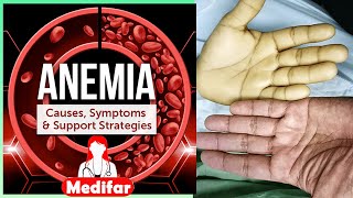 what is Anemia types symptoms and treatment in urduHindi by Medifar [upl. by Aryt863]