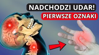 10 szokujących objawów udaru które musisz znać po 50 roku życia [upl. by Emelen]