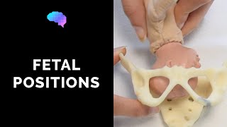 Types of Fetal Positions  OSCE Guide  UKMLA  CPSA [upl. by Abihsat]