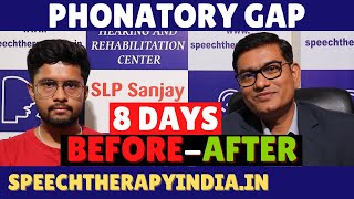 PrePost  Phonatory Gap  Voice Problem  Within 8 Days  By slpsanjaykumar  AIIMS Delhi Alumnus [upl. by Adnileb]