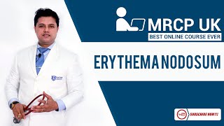 MRCP Part1  Erythema Nodosum [upl. by Desmund]