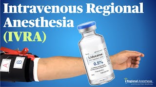 IVRA Intravenous Regional Anesthesia Theory tips and tricks [upl. by Oinoitna205]