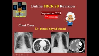 FRCR 2b Session 7 September 2024 Chest [upl. by Sac114]