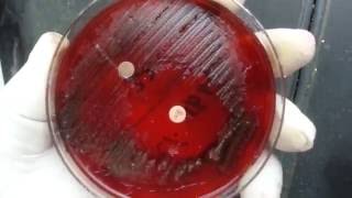 Anaerobic bacteria isolation in Microbiology  Clostridium [upl. by Ashlie108]