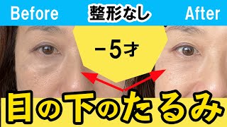 1週間で激変！目の下のたるみ整形級で取る！マッサージ＆エクササイズ ためしてガッテン [upl. by Marni580]