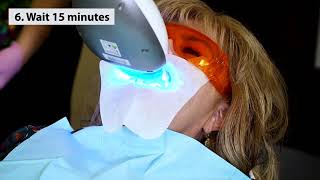 InOffice Whitening with Whiter Image [upl. by Krispin]