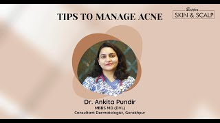 Tips To Manage Acne  Dr Ankita Pundir Gorakhpur [upl. by Ashwell707]