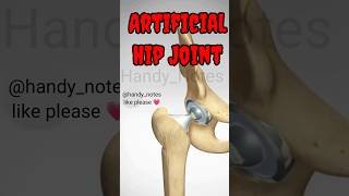 Artificial hip joint implant surgery bone joints anatomy [upl. by Htnnek]