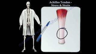 Achilles Tendon rupture Achilles tendon stress amp Strain Thompson test [upl. by Palestine147]