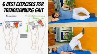 These Exercises Correct Your Abnormal Walking Pattern Trendelenburg Gait PhysiofitByDrMajid [upl. by Abbot]