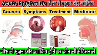 Epiglottitisगले में सूजन और गले का बंद होनाFull treatment in Hindithroatinfectionpainswelling [upl. by Adrell]