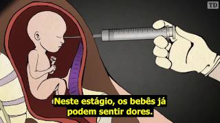 Como é realizado o aborto induzido no terceiro trimestre [upl. by Alekin914]