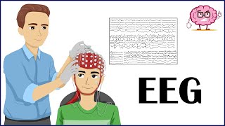 EEG Electroencephalogram  How It Is Done Indications Types Of EEG  Patient Education [upl. by Etnaid165]