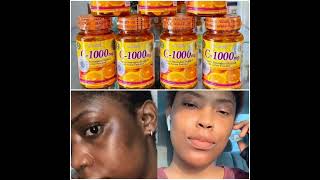 Vitamin C 1000mg Tablets codavailable [upl. by Socin]