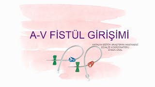 Arterio Venous Fistül Girişimi  AVF Girişimi [upl. by Cumine]