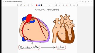 CARDIAC TAMPONADE [upl. by Phillip728]