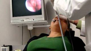 FinESS Sinus Treatment  Physician Instructional Video [upl. by Anayrb]